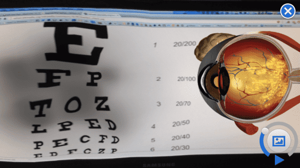 Eye Testing