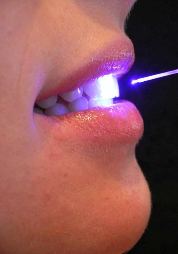 Laser and Dental 5