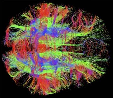 Nerve fibers in human brain