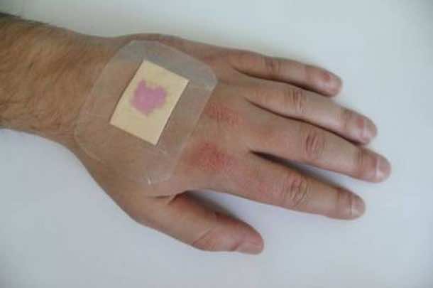 Smart Bandages – A helping hand for the doctors