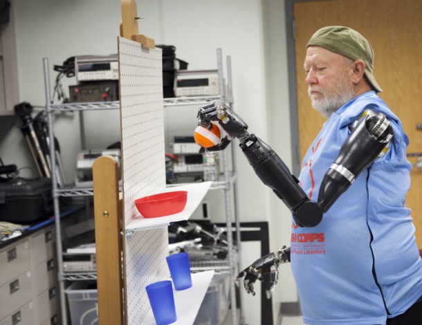Amputee Controls 2 Prosthetic Limbs by Using Mind 3