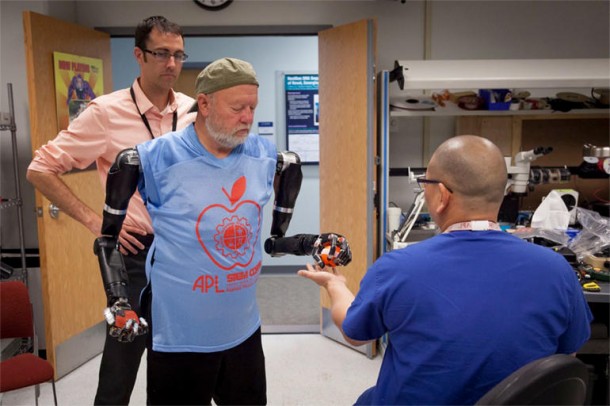 Amputee Controls 2 Prosthetic Limbs by Using Mind