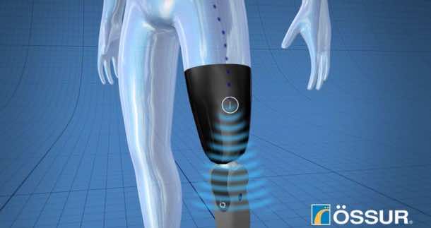 Mind Controlled Bionic Leg Prosthesis 3