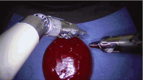 This Robot Performed Surgery And Saved The Wounded Grape 4