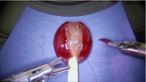 This Robot Performed Surgery And Saved The Wounded Grape