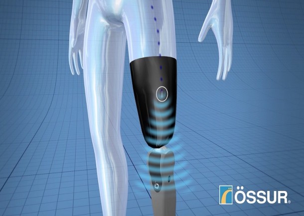 Mind-Controlled Bionic Limb For Amputees