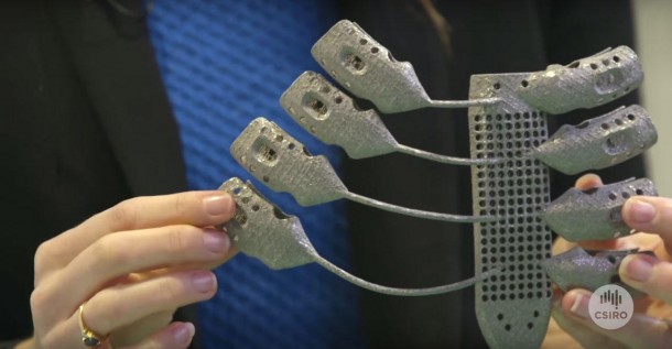 Patient Suffering From Cancer Received World’s First 3D Printed Rib Cage 3
