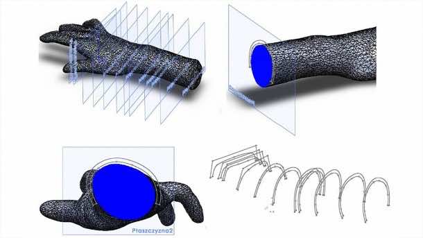 3D-printed Orthosis Helps Patients Suffering From Mild Paresis 2