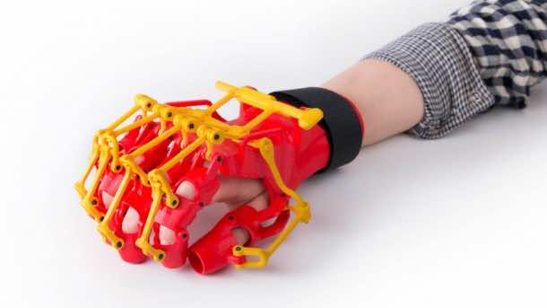 3D-printed Orthosis Helps Patients Suffering From Mild Paresis 4
