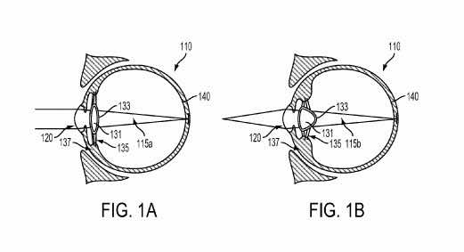 Google overtakes Sony's Smart Lens, Patents Smart Device injected into the eyeball_Image 1_Wonderful Engineering
