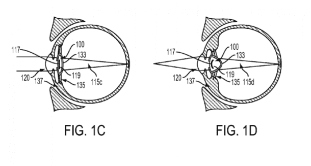 Google overtakes Sony's Smart Lens, Patents Smart Device injected into the eyeball_Image 2_Wonderful Engineering