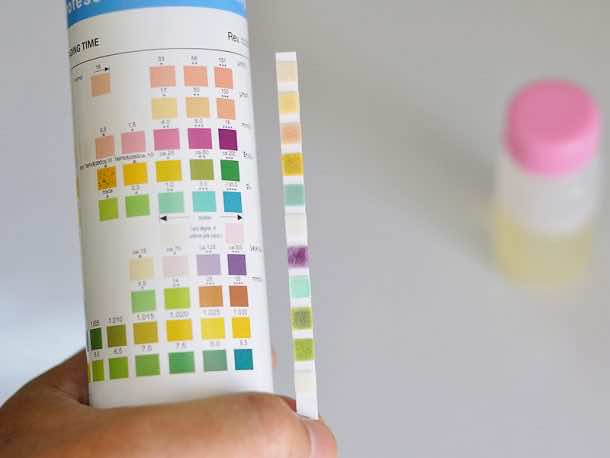 Stanford Engineers Design A Home Urine Test That Could Scan For Diseases_Image 0