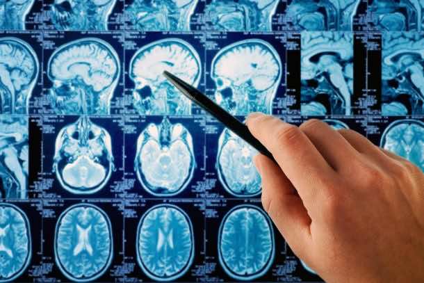 The 30-year Study Claims That Mobile Phones Dont Cause Brain Cancer_Image 4