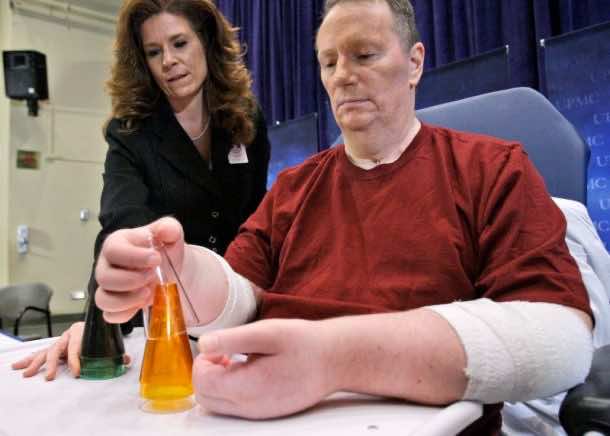 First American to Receive Double Hand Transplant Reveals It Was Unsuccessful_Image 1