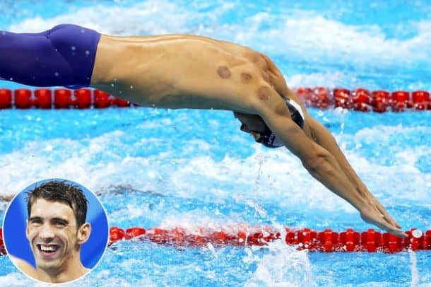 US swimmer Michael Phelps, winner of 21 Olympic gold medals, sporting cupping bruises on his shoulders and back