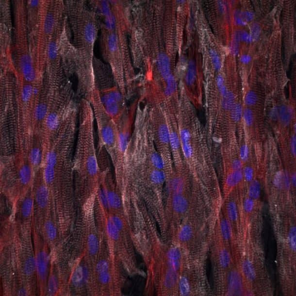 A close-up of the cardiac tissue on the chip(Credit: Johan Lind, Francesco S. Pasqualini, Disease Biophysics Group/Harvard University)