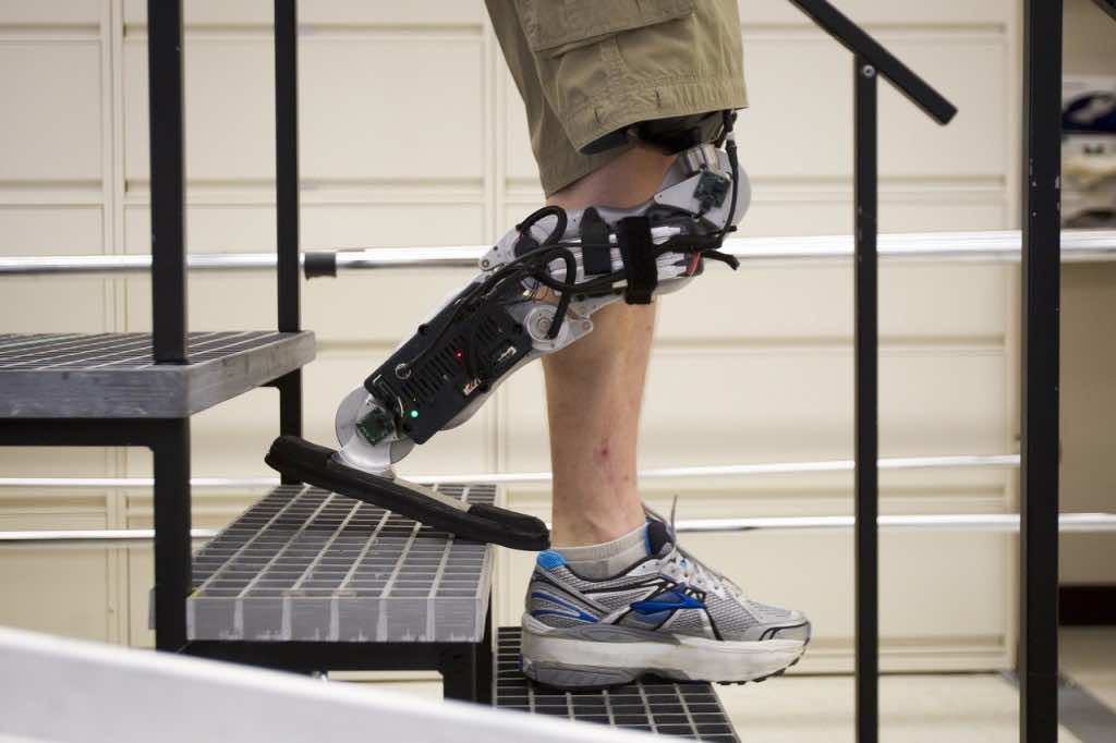 Bionic Leg Gives New Hope To Disabled People