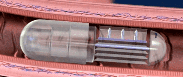 Robotic Pills May Soon Replace Conventional Medicines