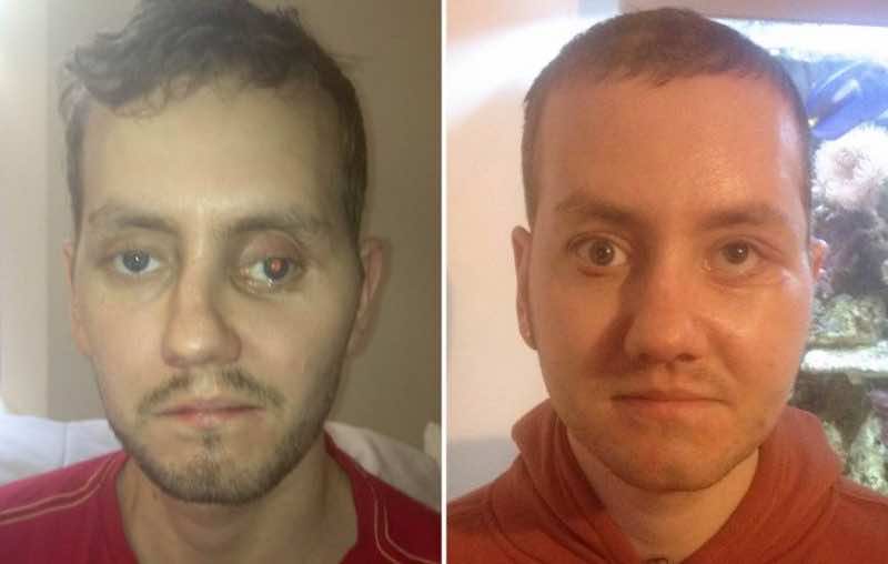 Doctors Use 3D Printed Bones To Reconstruct The Face Of A Pa