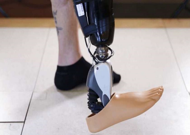 Mind-Controlled Bionic Limb For Amputees 3