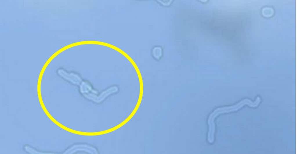 Ever Wondered What Are Those Floating Objects In Your Eyes?