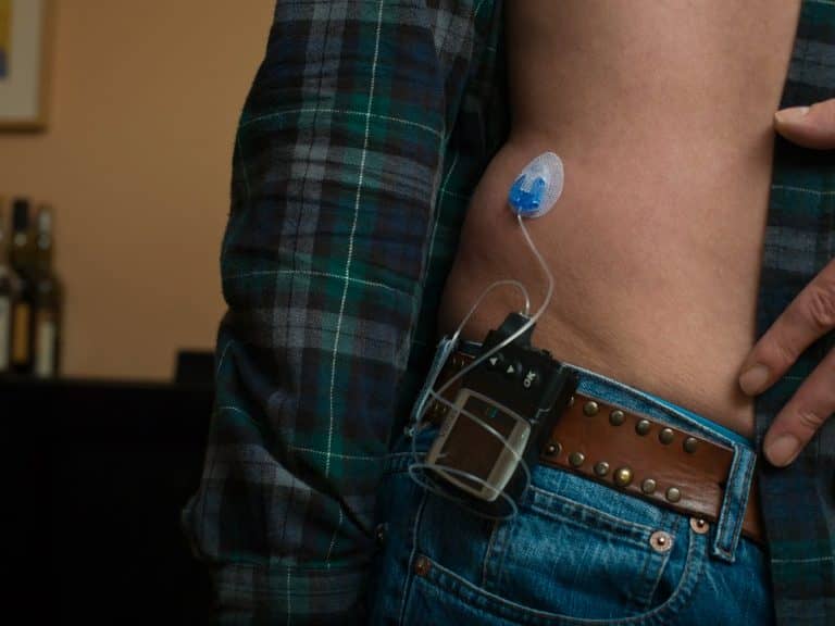 The World’s First Artificial Pancreas Just Got Approved