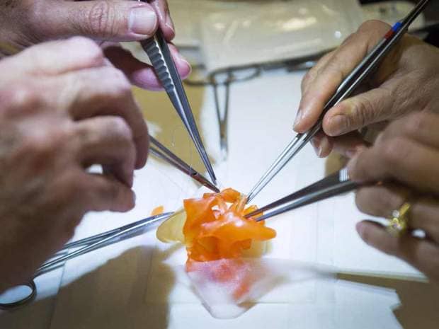 hospitals-are-printing-3-d-hearts-to-help-in-surgeries_image-2
