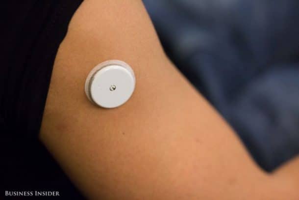 this-wearable-monitors-your-blood-glucose-levels-in-real-tim