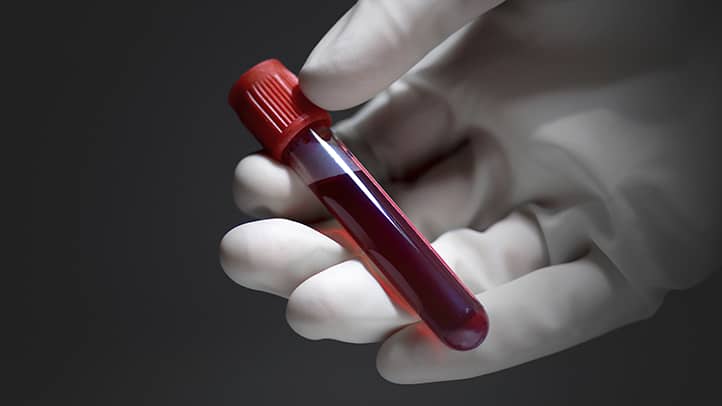 Blood Test Cancer Diagnosis Algorithm