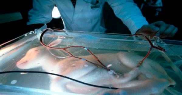 Artificial Womb (3)