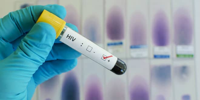 clinical trial for gammora cure for HIV patients