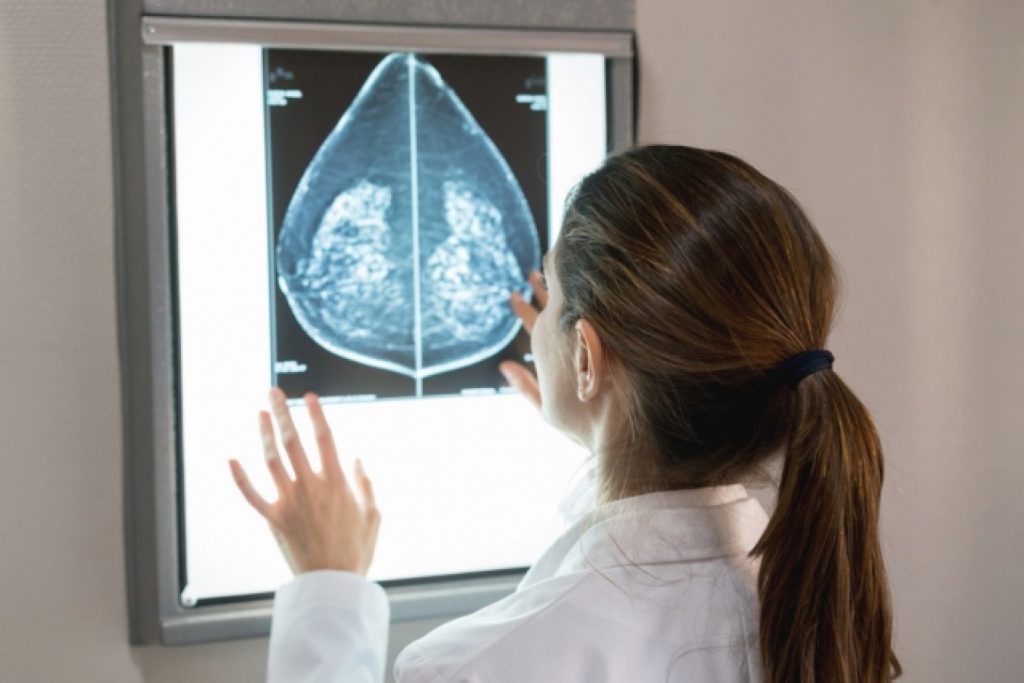 ai-can-now-detect-breast-cancer-as-accurately-as-an-average