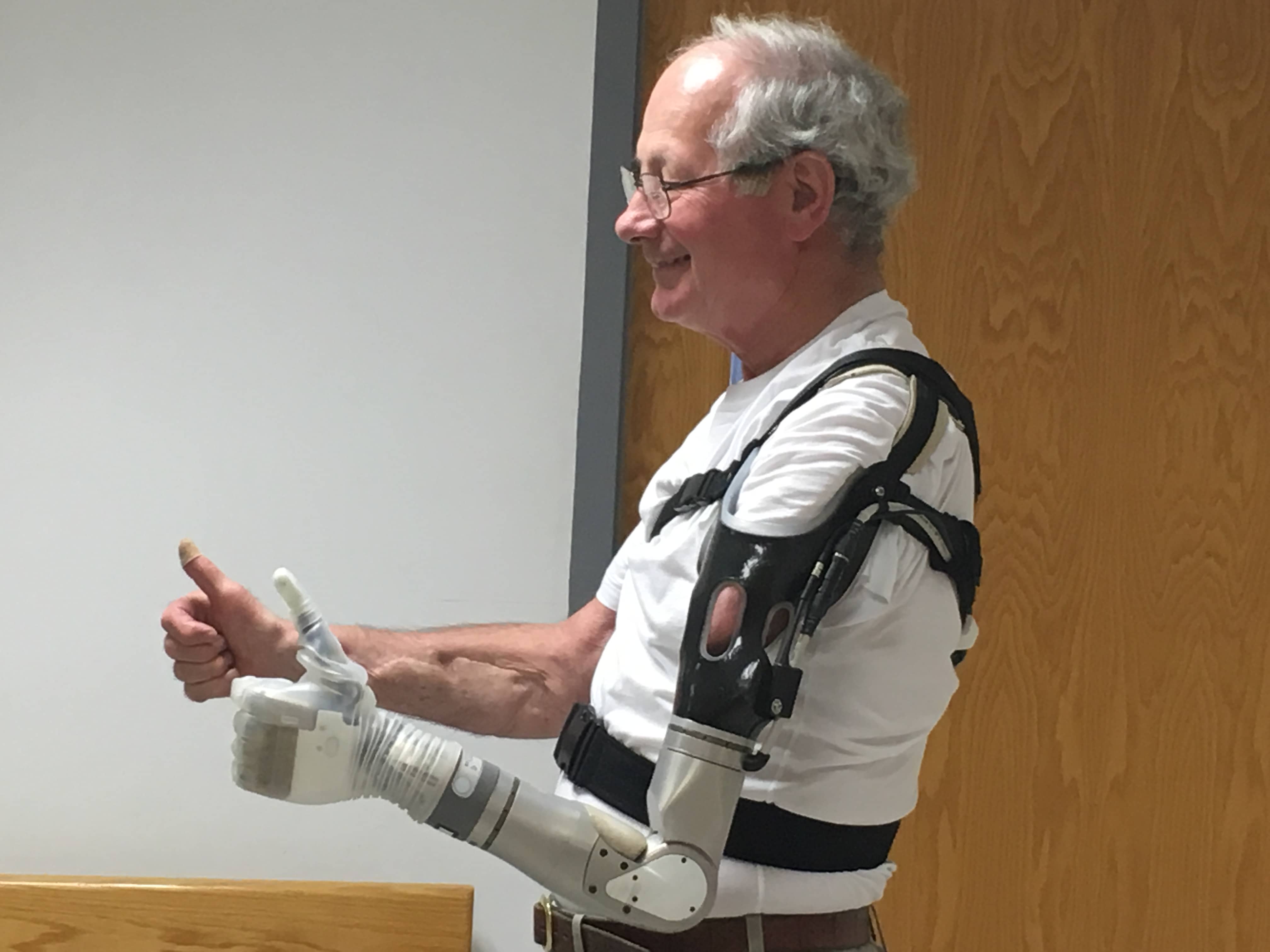 LUKE Arm Is A Prosthetic Arm That Can Sense & Touch!