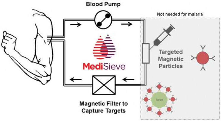 MediSieve Can Remove Diseases From The Blood Using Magnets