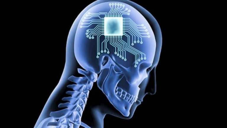 Neuralink Could 'Sell Your Private Thoughts To The Highest Bidder'