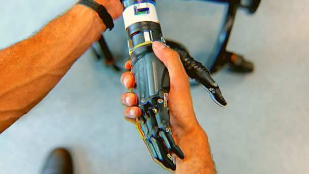 Scientists Are Developing The Next Generation Of Bionic Limb