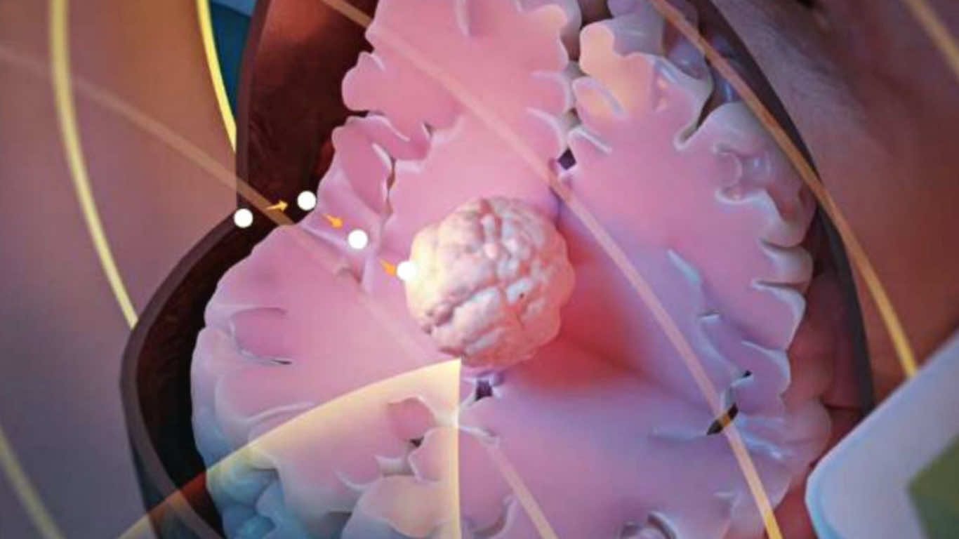 These New 'Seeds' Can Heat Up And Kill Cancer